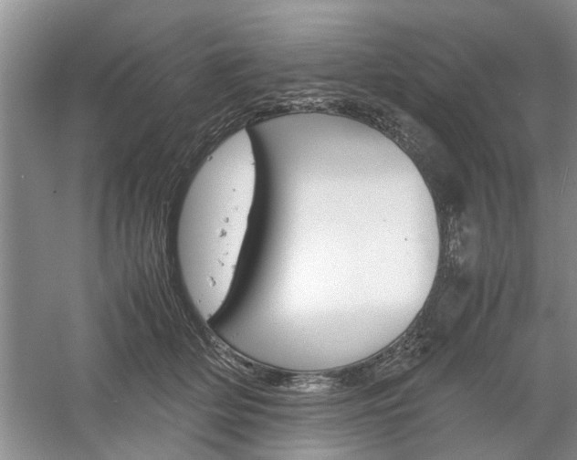 X0000061140514200511181010