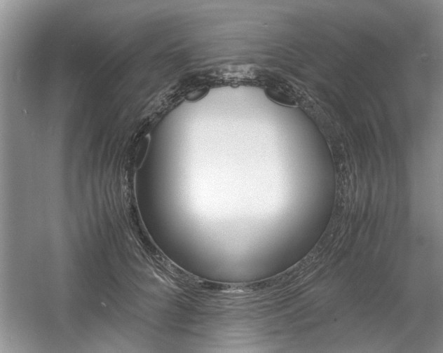 X0000061140704200511181007