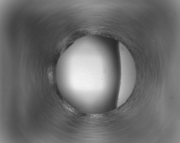 X0000061140720200511181006