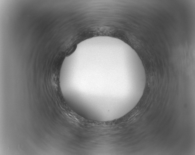 X0000061141010200511181000