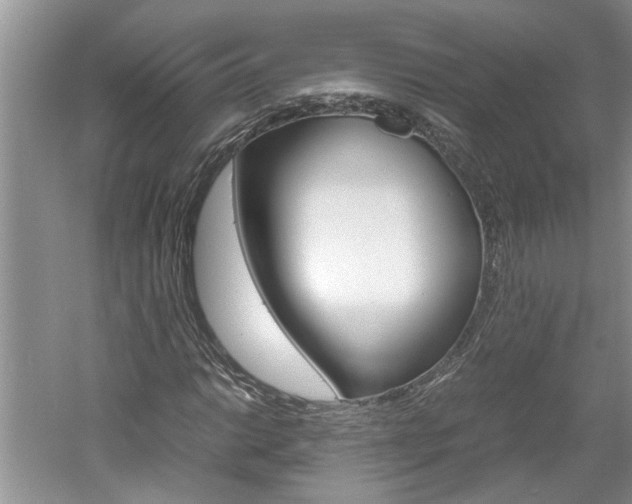 X0000061141014200511181000