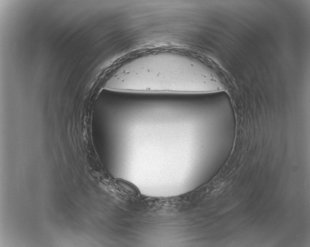 X0000061141016200511181000
