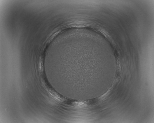 X0000061140170200511181217