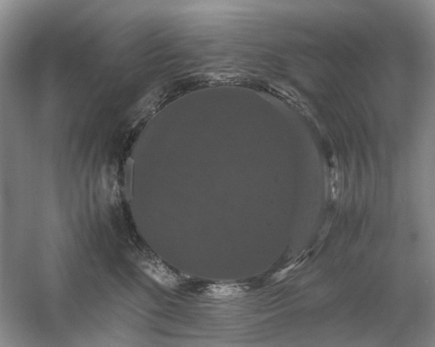 X0000061140520200511181211