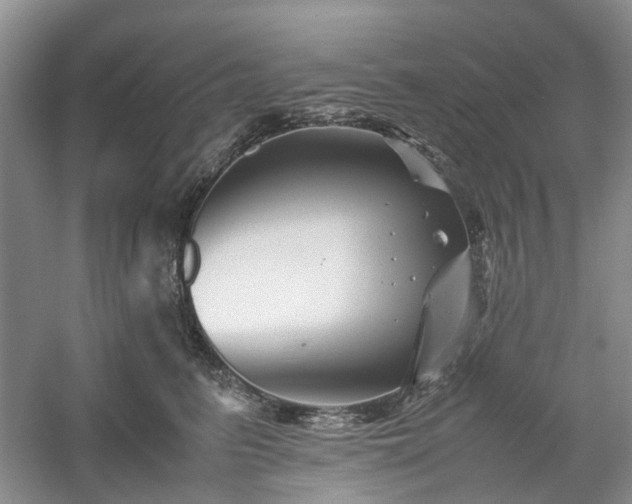 X0000061140615200511181210