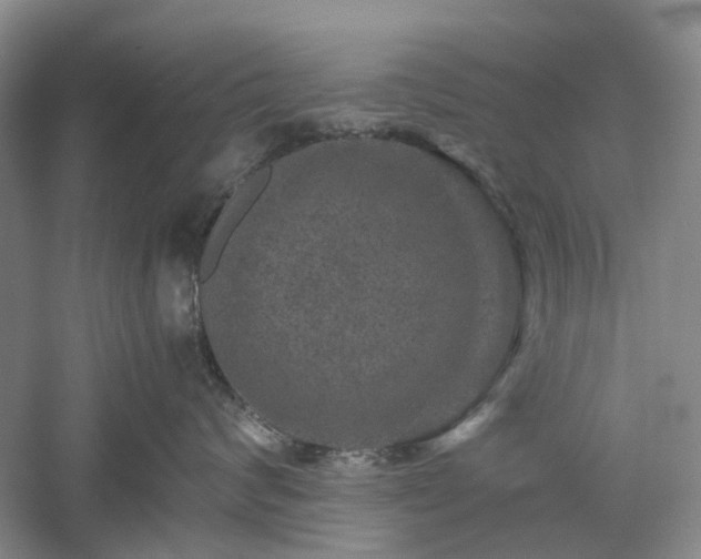 X0000061140624200511181209