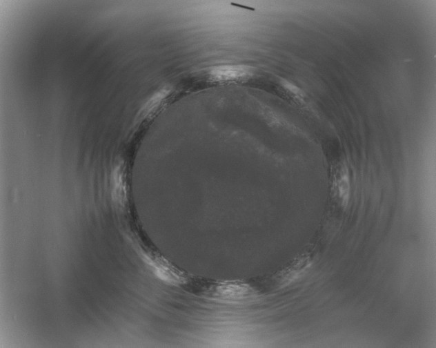 X0000061140716200511181208