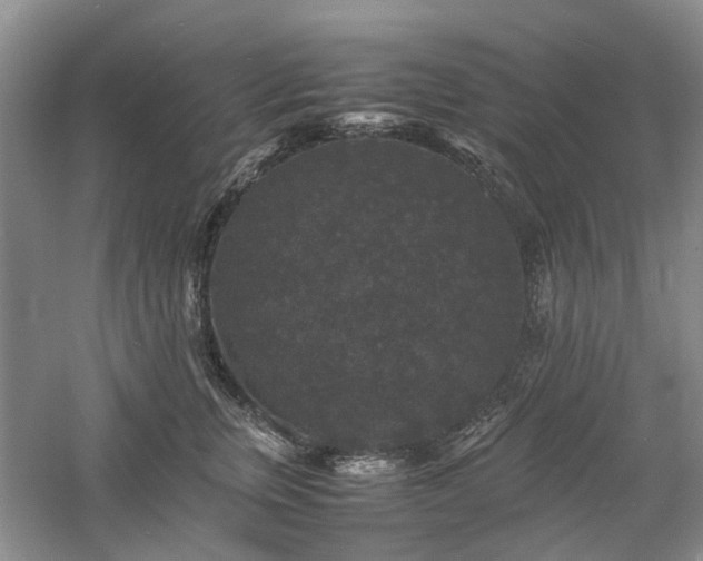 X0000061140759200511181208