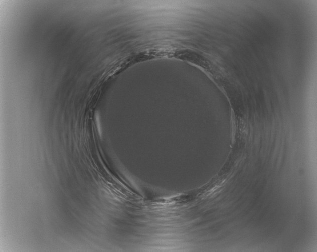 X0000061140818200511181205