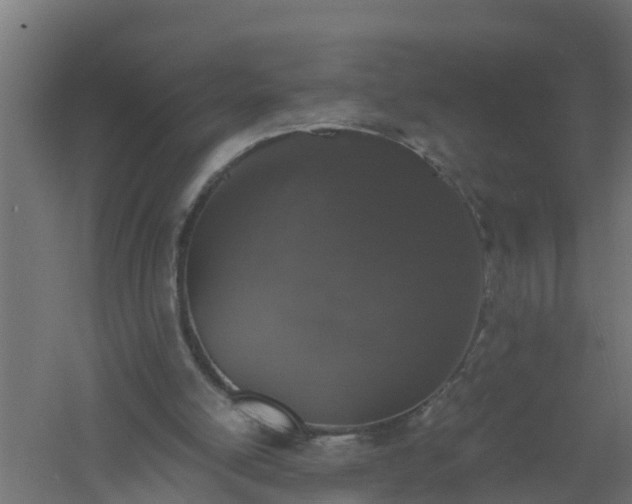 X0000061140054200511241815