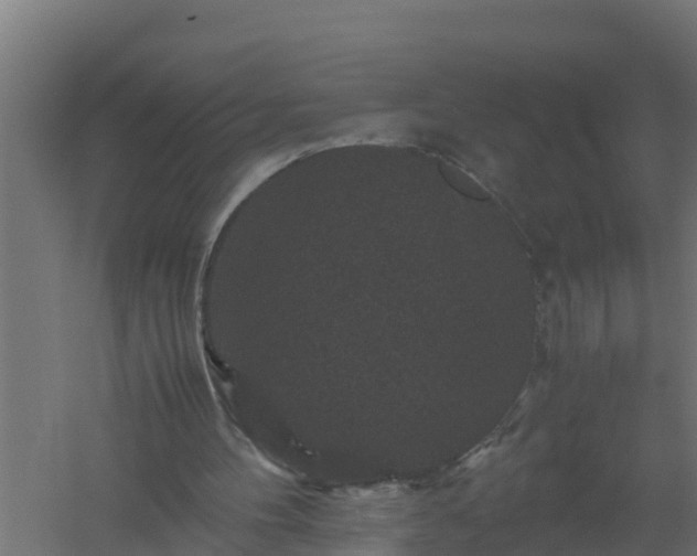 X0000061140100200511241815