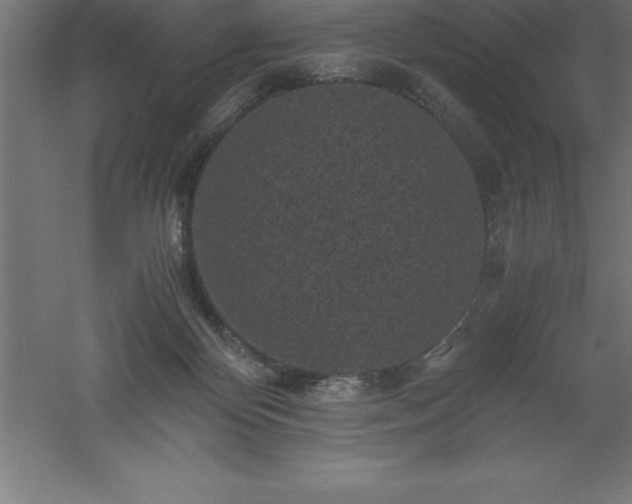 X0000061140124200511241814