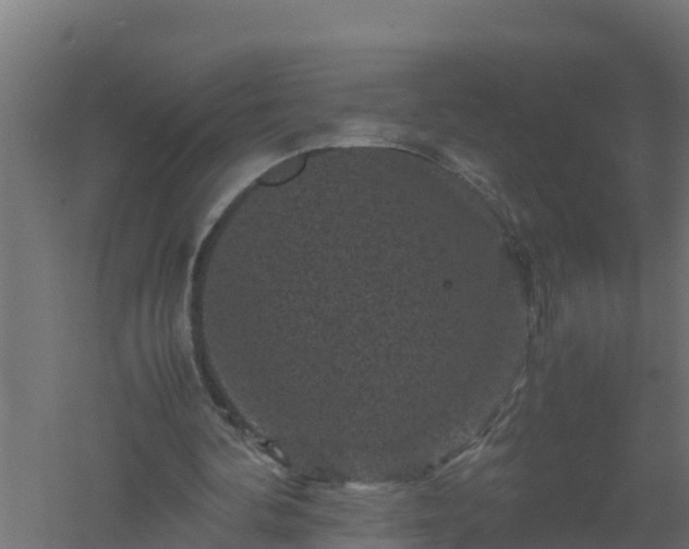 X0000061140292200511241811