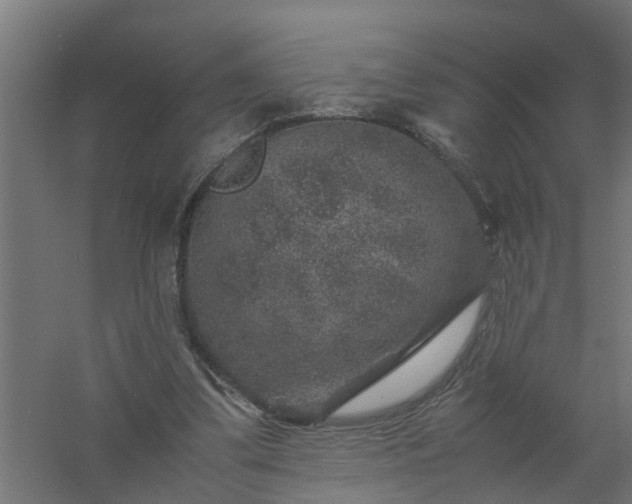 X0000061140299200511241811