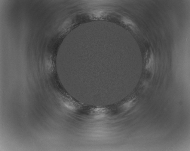 X0000061140324200511241811