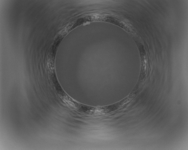 X0000061140419200511241809