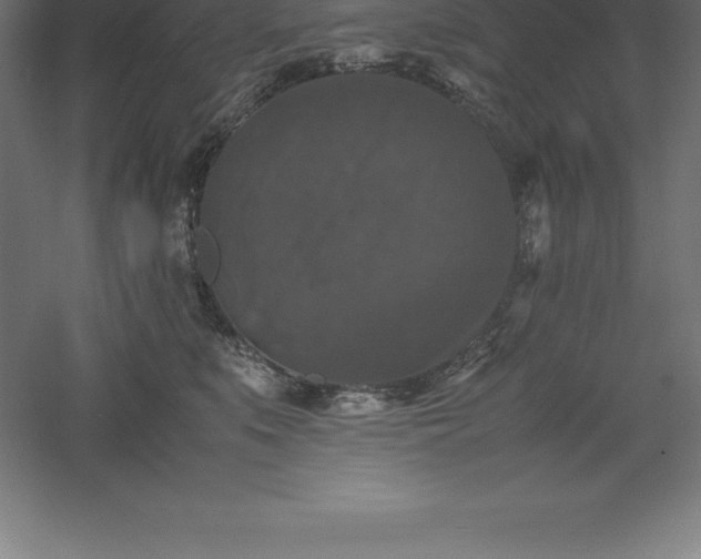 X0000061140519200511241807