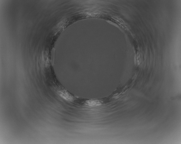 X0000061140520200511241807