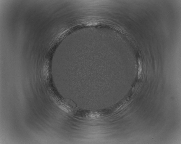 X0000061140600200511241806