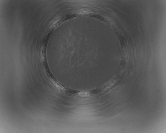 X0000061140762200511241803