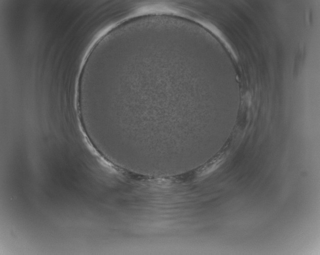 X0000061140815200511241802