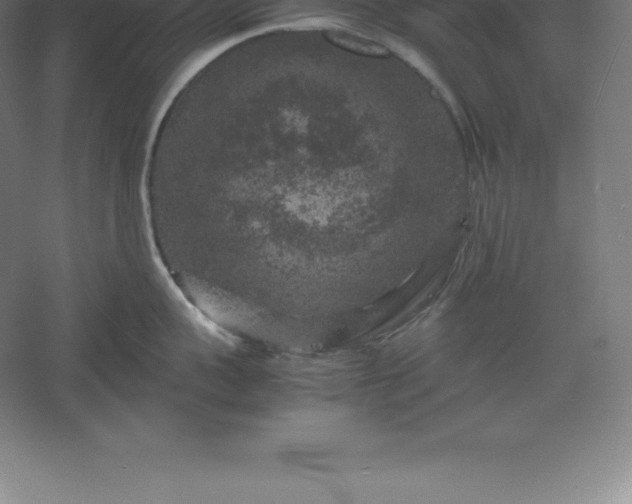 X0000061140959200511241800