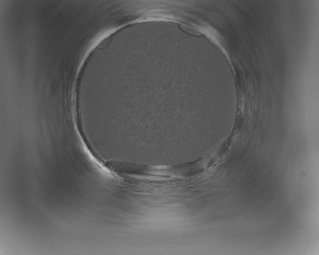 X0000061141003200511241759