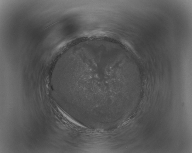 X0000061141063200511241758