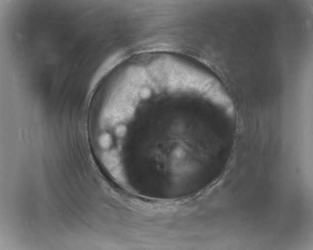 X0000061140004200512022300