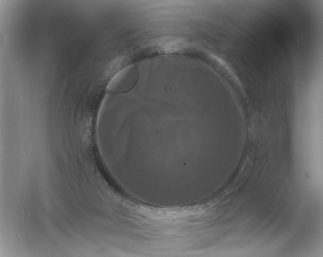 X0000061140018200512022300