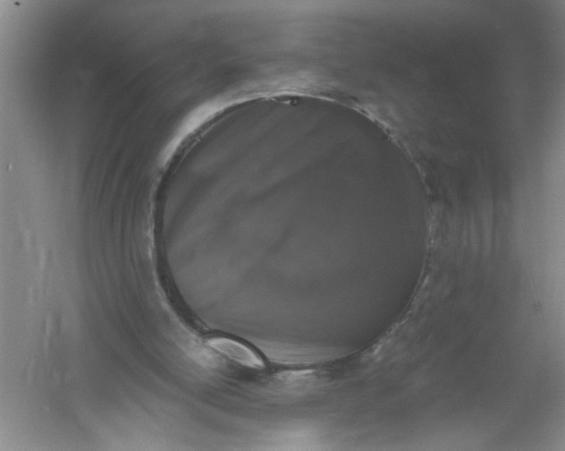 X0000061140054200512022258