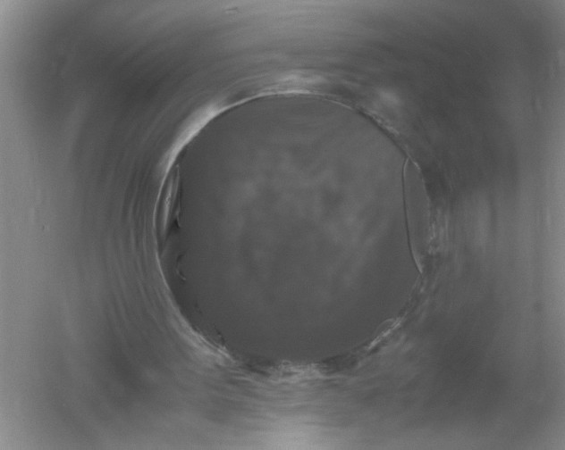 X0000061140099200512022258