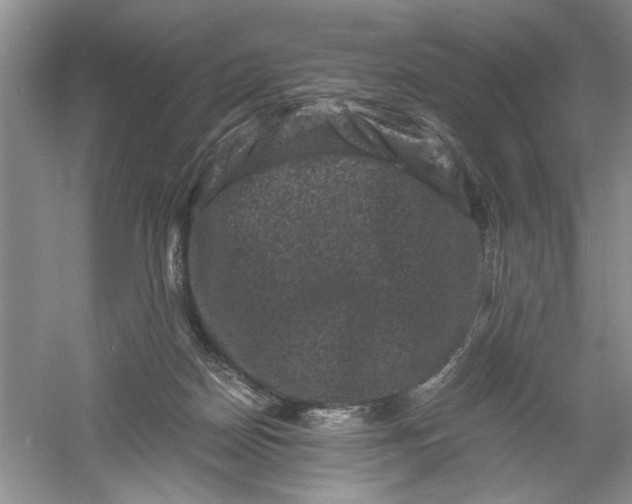 X0000061140170200512022257