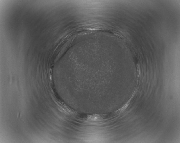 X0000061140174200512022257