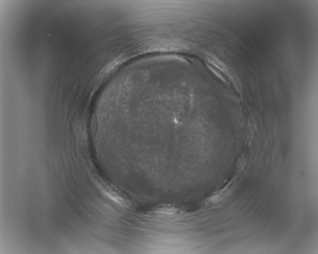 X0000061140203200512022256