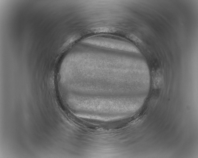 X0000061140207200512022256