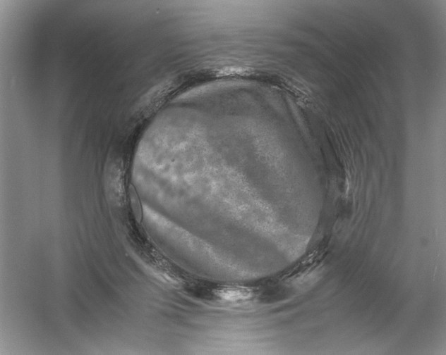 X0000061140215200512022256