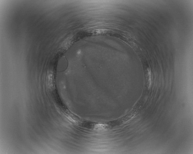 X0000061140222200512022256