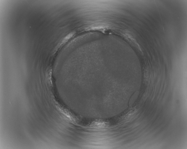 X0000061140260200512022255