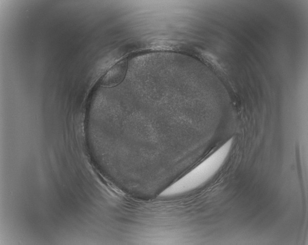 X0000061140299200512022255