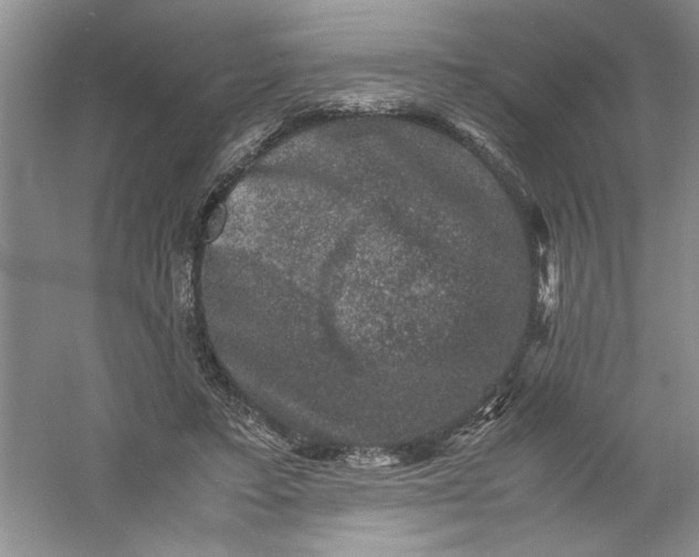 X0000061140403200512022253