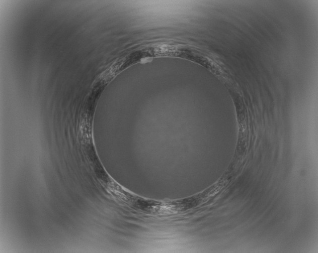 X0000061140419200512022252