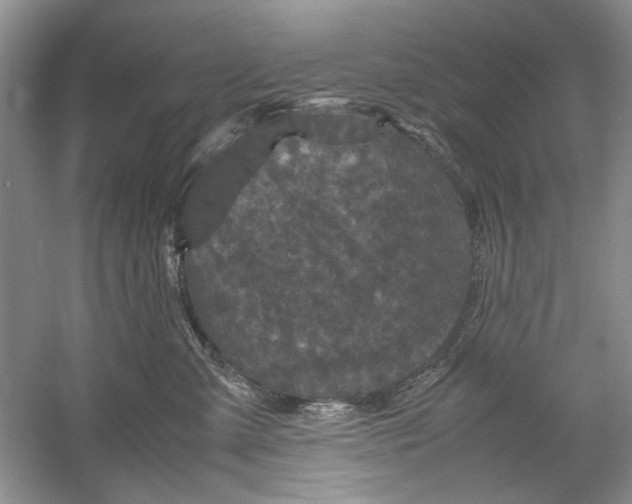 X0000061140427200512022252