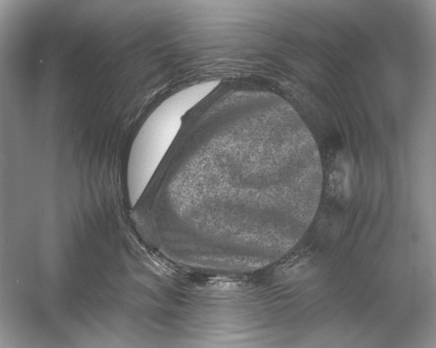 X0000061140620200512022249