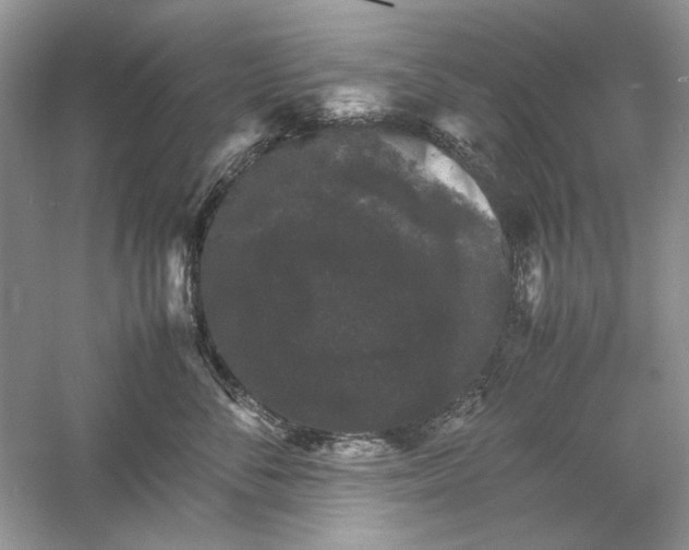 X0000061140716200512022247