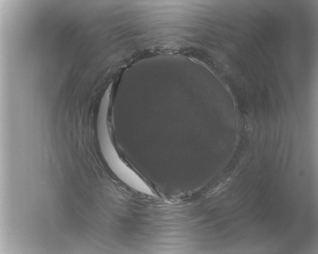 X0000061140818200512022245