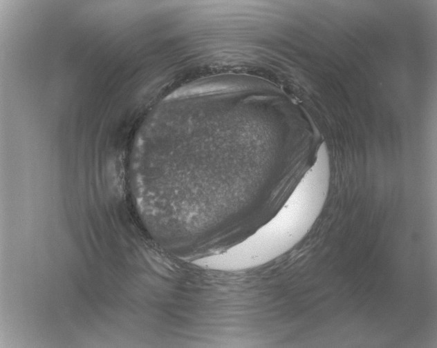 X0000061140868200512022245