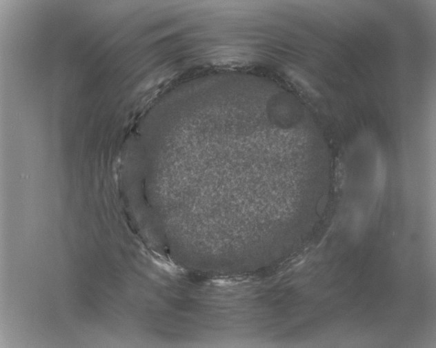 X0000061140917200512022243