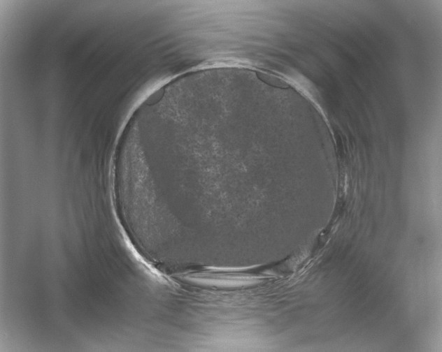 X0000061141003200512022242