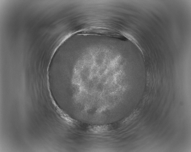 X0000061141047200512022242